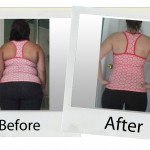 ba15 your-hcg-before-after_lara